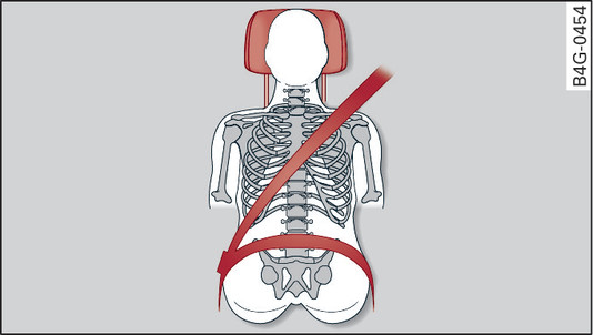 Fig. 263 Head restraint (seen from the front)